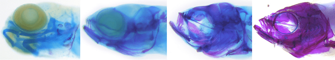 The zebrafish skull transitions from primarily cartilage (blue) in larvae to primarily bone (magenta) in adults. Primary investigator Lindsey Barske uses zebrafish models in her human genetics lab at Cincinnati Children's.